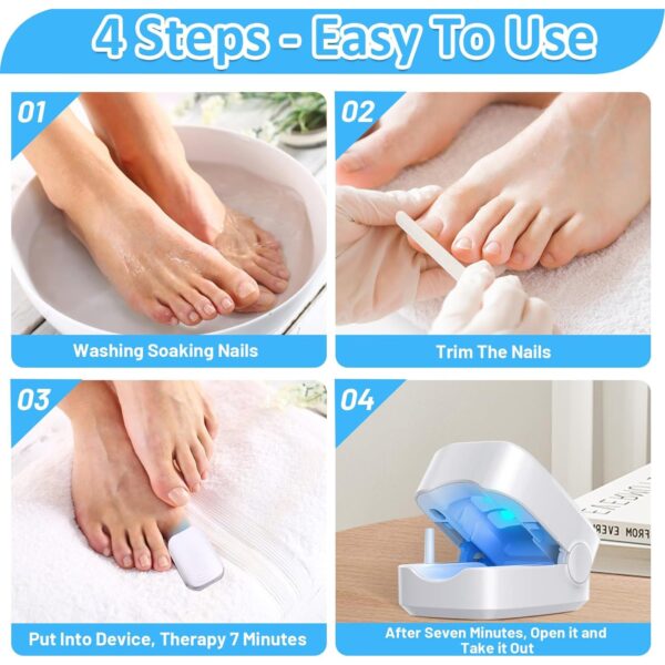 Rechargeable Nail Fungus Treatment for Toenail, Toe Nail Fungal Treatment Nail Fungus Laser Device, Anti-Fungal Nail Treatment for Hand & Feet Infections Remover for Home Use - Image 6