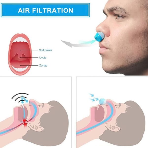 2 in 1 Anti Snoring and Air Purifier Nose Clip Anti Snoring Device (1 Pc / With Plastic Case) - Image 3