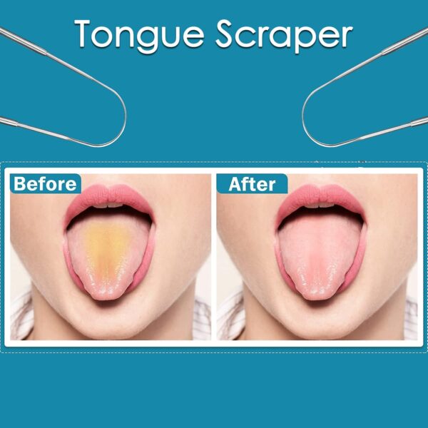 Tongue Cleaner For Kids & Adults | Tongue Scraper For Bad Breath, Maintain Oral Hygiene for Daily Use | for Fresh Breath & Bacteria Removal | Improved Taste (Steel, Copper, Tongue Cleaner / 1 Pc) - Image 4