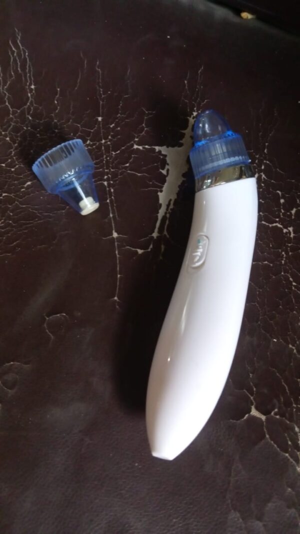 2 in 1 Blackhead Whitehead Extractor Remover Device (Multi-Color / 1 Set / batteries not included) - Image 8